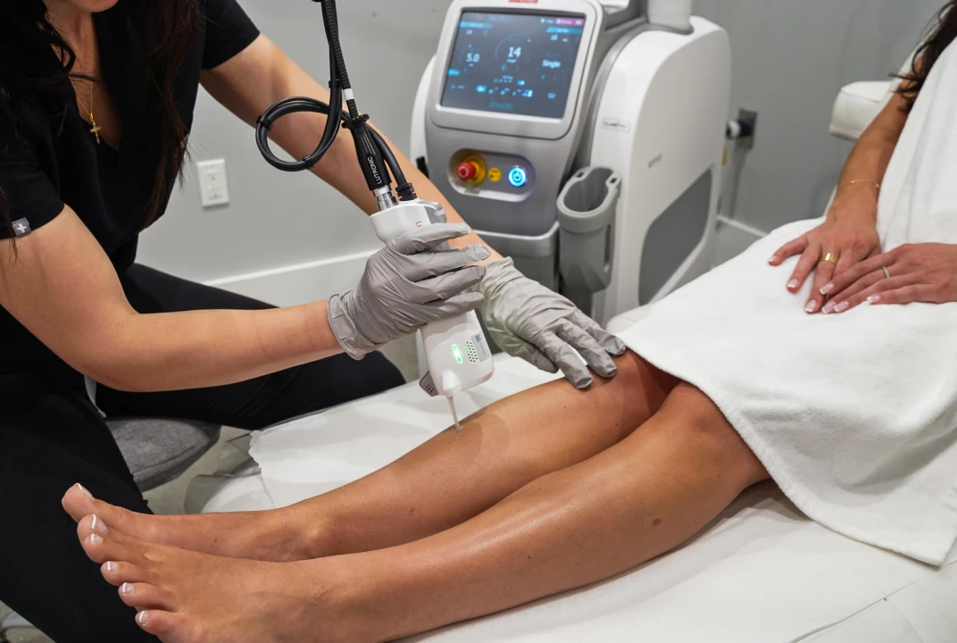 Image of a laser hair removal session at Liv Aesthetics LLC in Thornwood, NY. A technician uses a handheld laser device on a client’s leg, highlighting a precise, professional treatment designed for smooth, long-lasting hair reduction.
