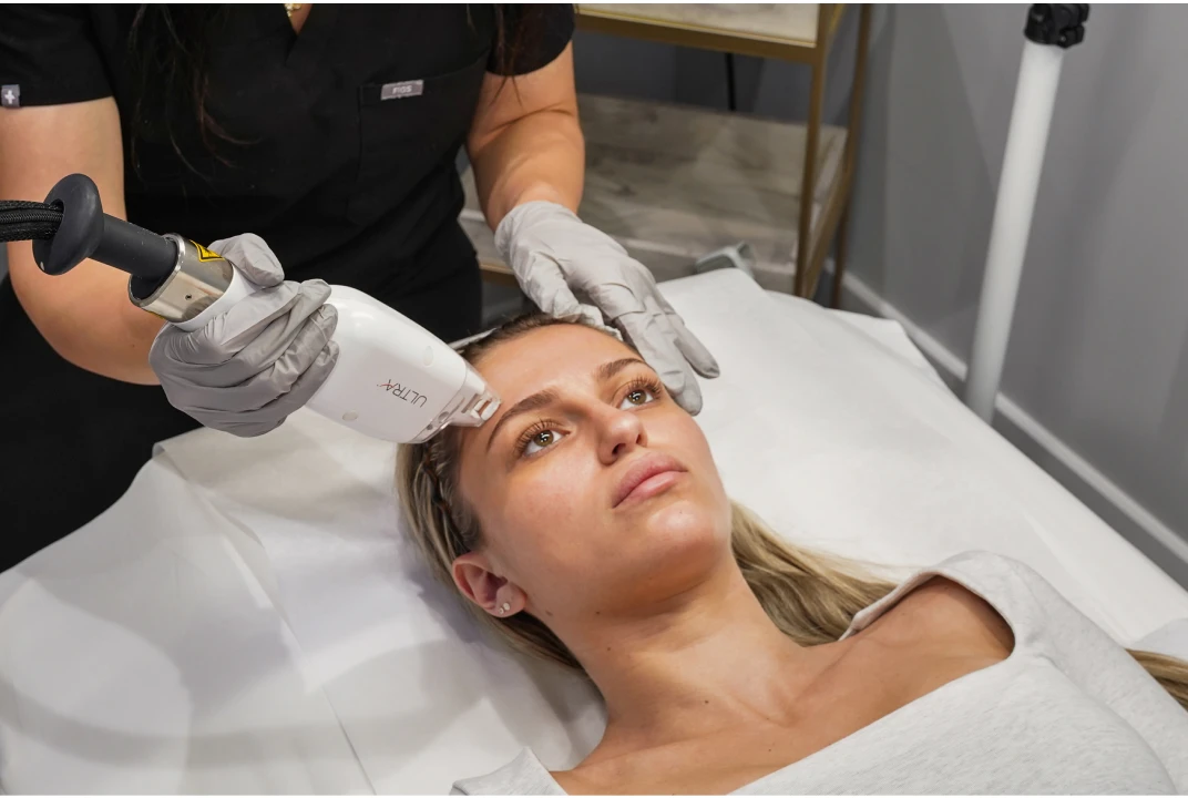 Photo of an Ultra laser treatment at Liv Aesthetics LLC in Thornwood, NY. A technician uses a precision laser device on a client’s face, demonstrating a non-invasive skin rejuvenation service aimed at improving tone, texture, and overall radiance.